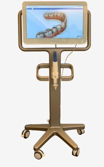 「iTero(アイテロ)」