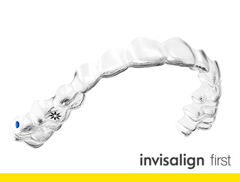 インビザライン・ファーストって? イメージ1