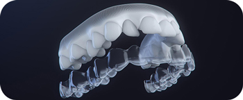 テクノロジーを用いた明瞭な治療 イメージ4