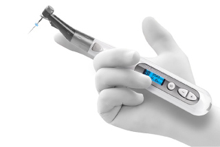 歯根治療（根管治療）