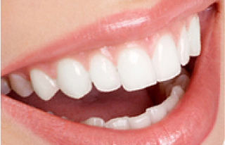 ホワイトニング(歯牙漂白)